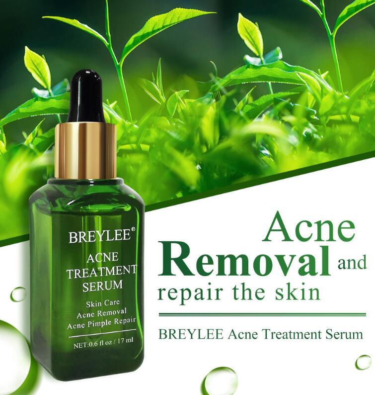 Aknebehandlung Serum Gesichtsreparatur Öl für Holen