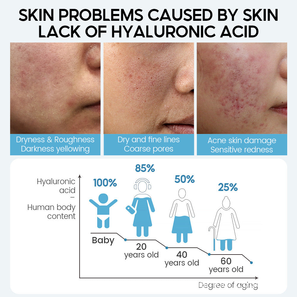 Hyaluronsäure-Gesichtsserum Anti-Aging Porenverkleinerung Aufhellende Feuchtigkeitsspendende Gesichtscreme für trockene Hautpflege